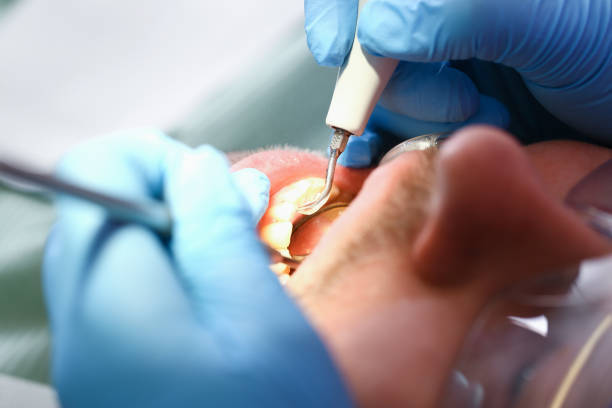 Best Dentist Open Late Near Me  in Llington, MI