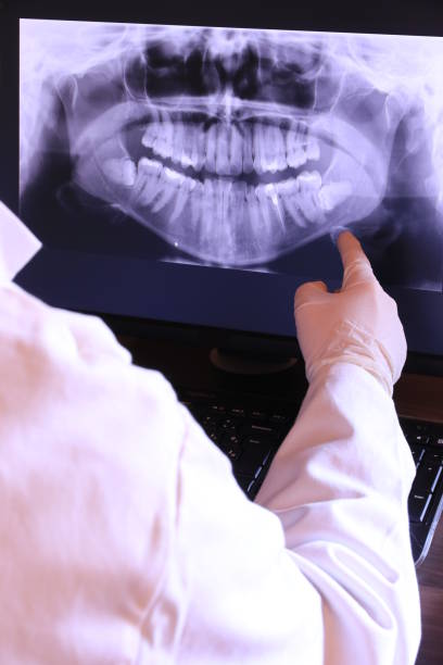 Best Urgent Tooth Repair  in Llington, MI