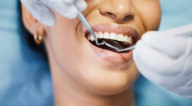 Best Affordable Emergency Dental Care  in Llington, MI