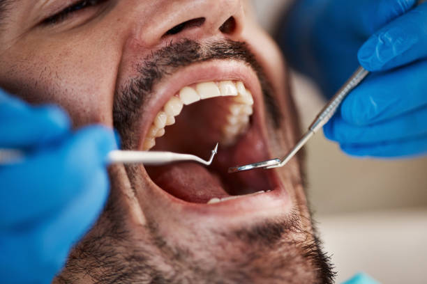 Best Emergency Tooth Extraction  in Llington, MI